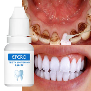 EFERO Teeth Whitening Essence Oral Hygiene Cleaning Serum Powder Remove Plaque Dental Tool Bleaching Tooth Whitening Tooth Tool